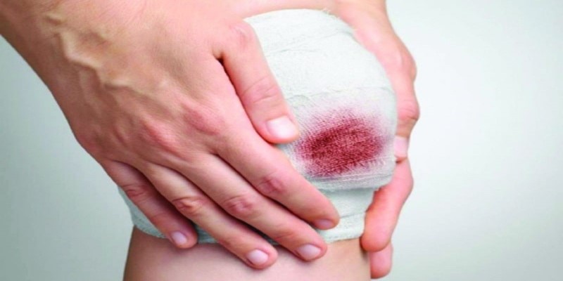 Gợi ý về ngủ mơ thấy máu đánh số mấy trong lô đề