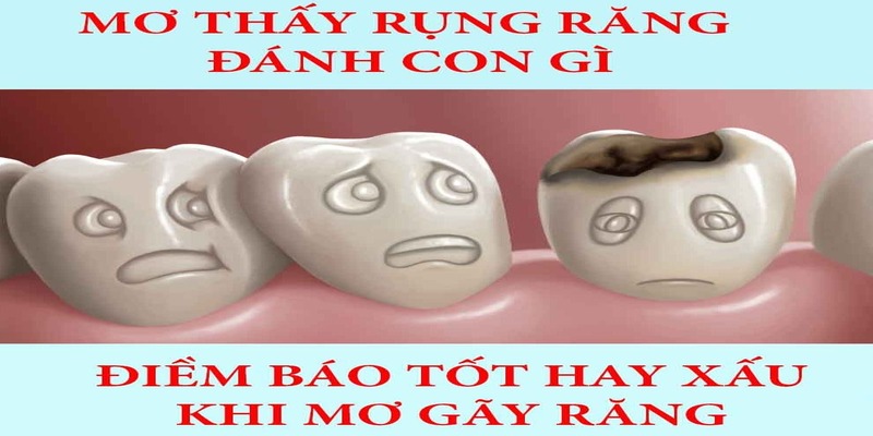Nằm mơ rụng răng đánh con gì liên quan đến sự nghiệp