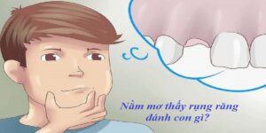 Nằm Mơ Thấy Rụng Răng Đánh Con Gì - Tham Khảo Ngay Số May Mắn